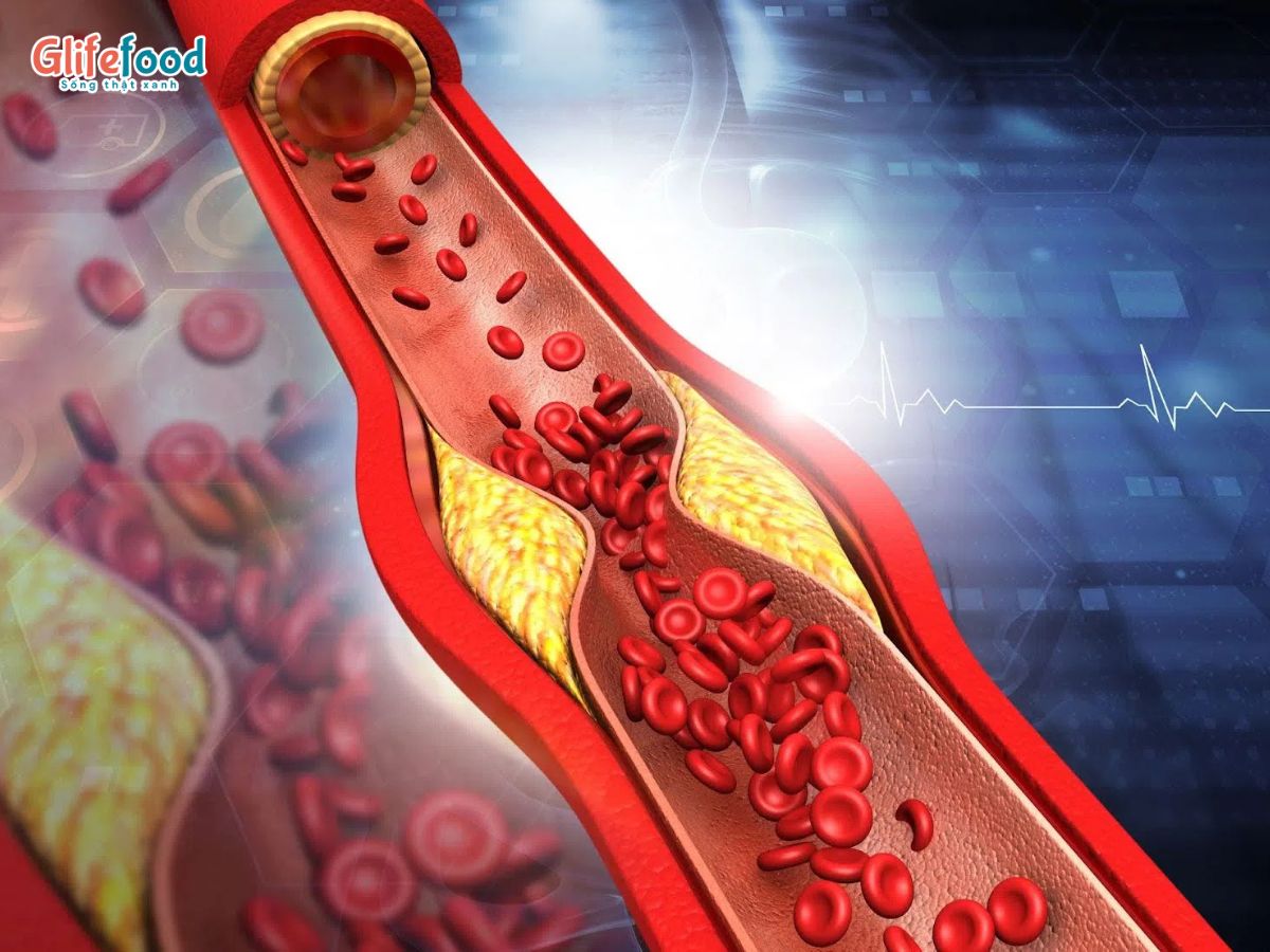 TẢO XOẮN CHILE SEWE: HÀNG RÀO BẢO VỆ TRÁI TIM VÀ NGĂN NGỪA NGUY CƠ ĐỘT QUỴ